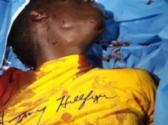 Hamdallaye2 : Un jeune รlรจve ร l’attente de son rรฉsultat du BEPC Succombe ร ses blessuresโฆ